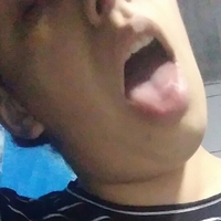 abyrodr Nagie