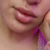 Blixi Nagie
