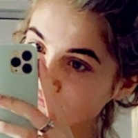 tiexox2 Nagie