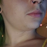 xxxanthisma Nagie